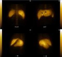 Liver and bile-excreting duct examination