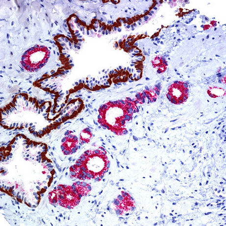 Immunohistochemistry studies