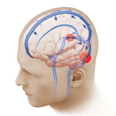 Treatment and rehabilitation of nervous disorders