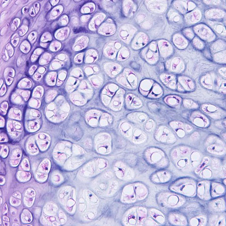 Urgent histological study during an operation