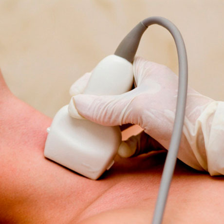 Ultrasonography of brachiocephalic vessels