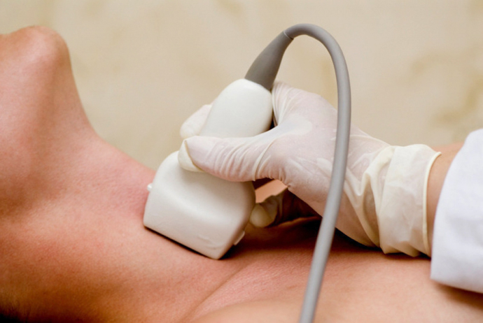Cerebral vessel ultrasonography