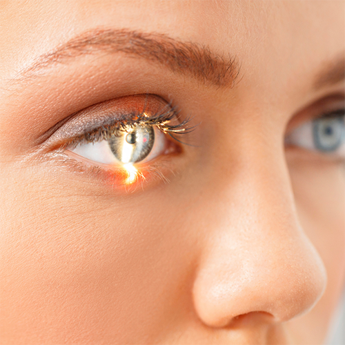 «Innovative ophthalmology»