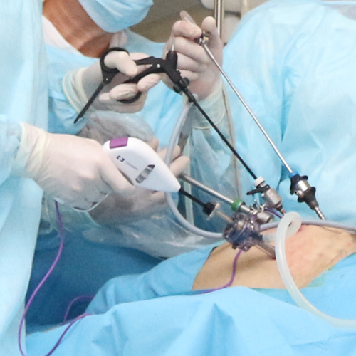 Surgical treatment of prostate gland diseases