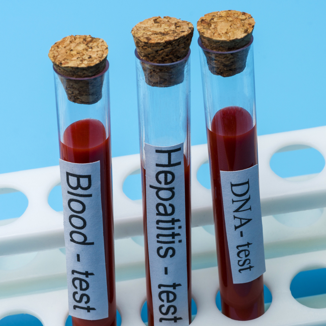 Laboratory tests