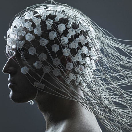 Electroencephalography