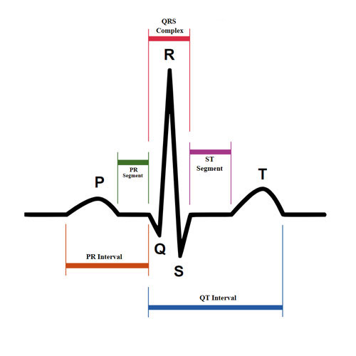 Surgical treatment of ciliary arrhythmia with the use of the cryo ablation technique