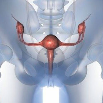 Surgical treatment of descent and prolapse of geital organs