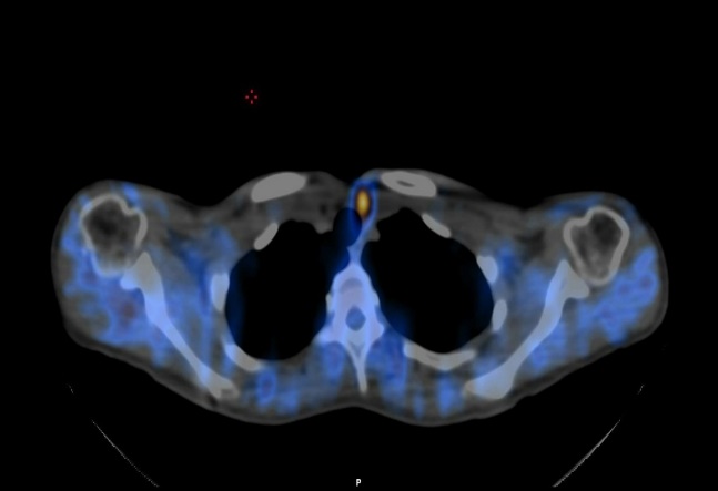 Parathyroid glands examination