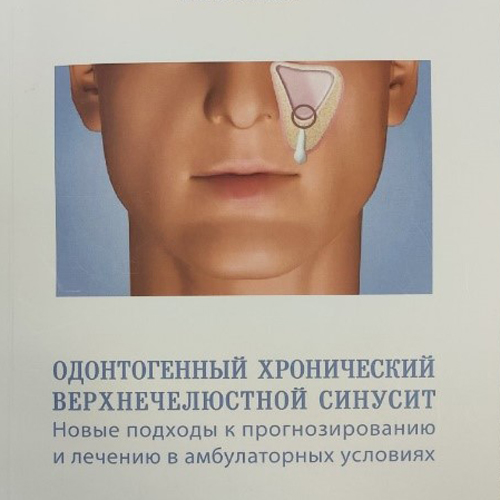 Odontogenous chronic siagonantritis