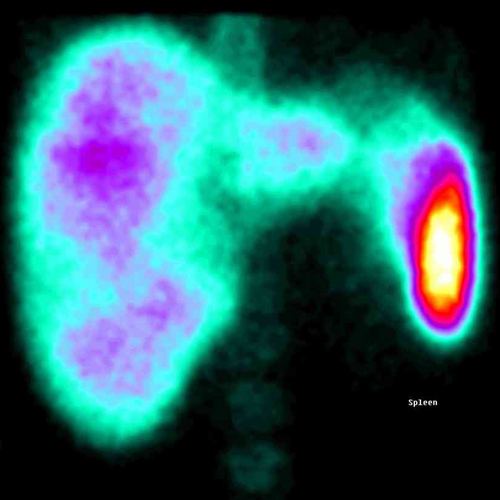 Liver and spleen examination