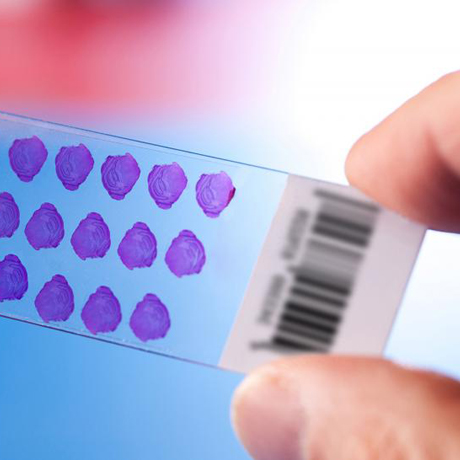 Consultation on previously prepared histological slides