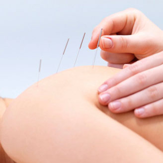 Needle therapy procedures