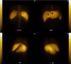 Liver and bile-excreting duct examination