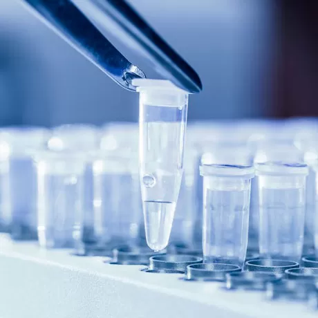PCR diagnostics