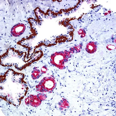 Immunohistochemistry studies
