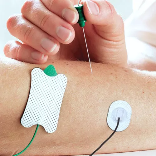 Electroneuromyography (ENMG)