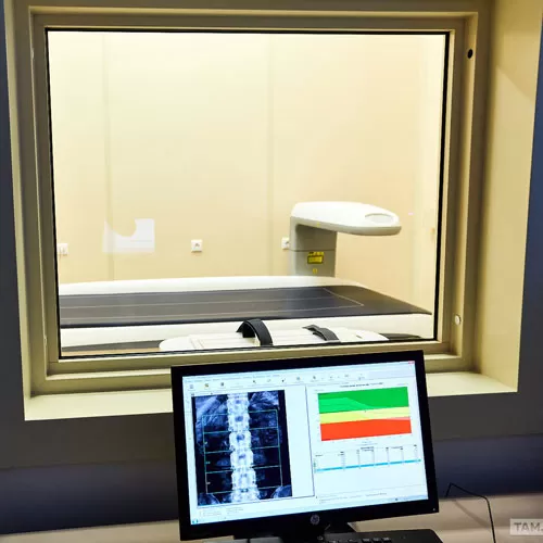 X-ray densitometry