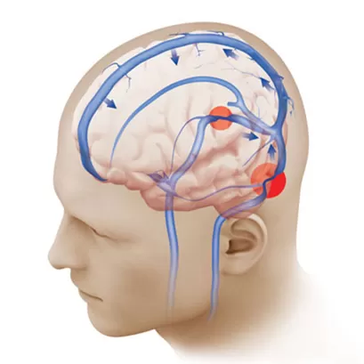 Treatment and rehabilitation of nervous disorders