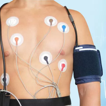 24-hour ECG and arterial blood pressure monitoring
