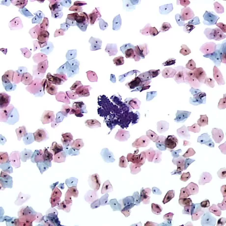 Liquid-based cytology
