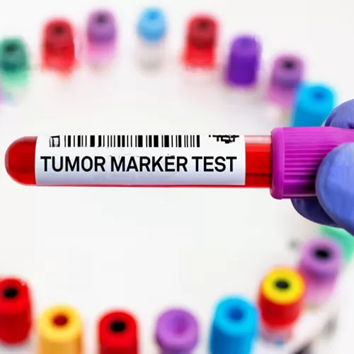 What you need to know about tumor markers