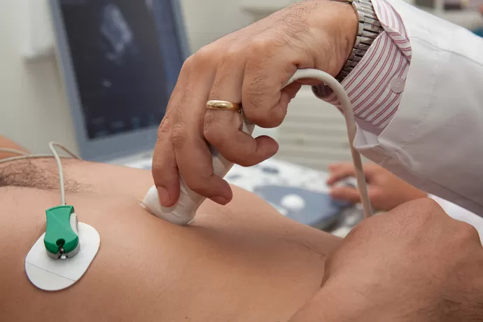 Echocardiography