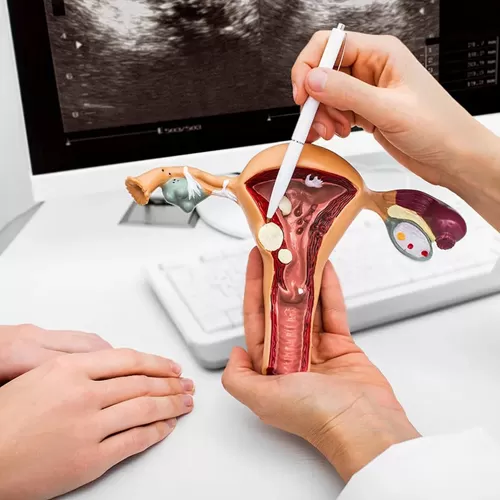 Free endometriosis treatment consultation