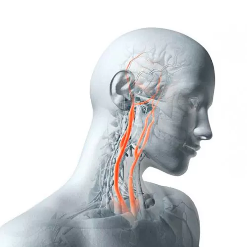 Vascular surgery