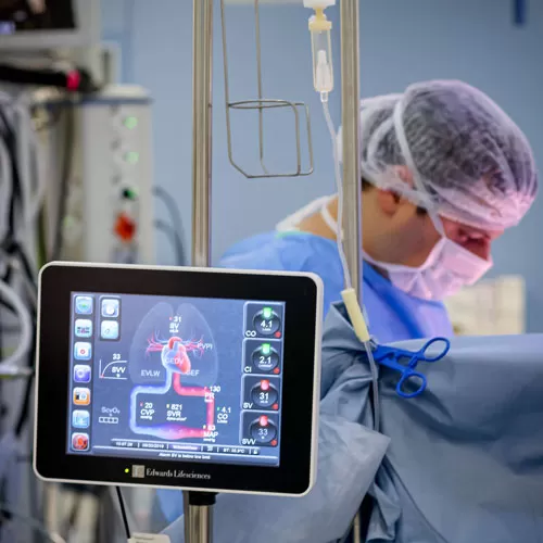 Blood assist systems