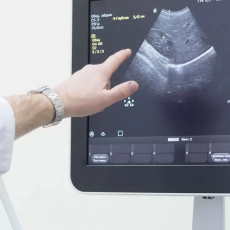 Prostate gland ultrasonography