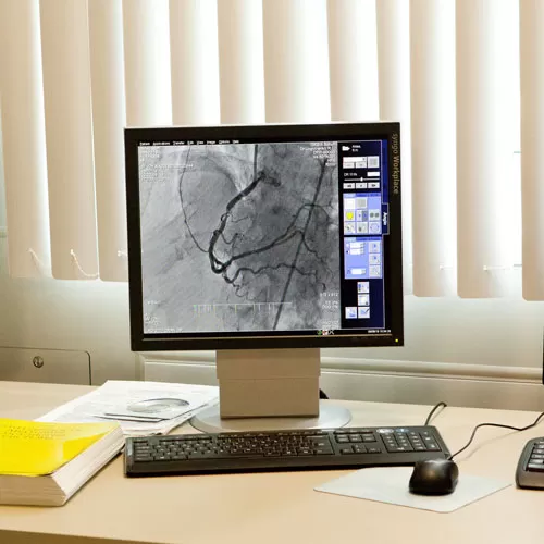 Radiofrequency ablation