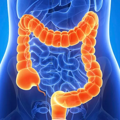Surgical interventions on the intestines