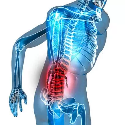 Treatment of neck pain