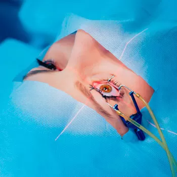 Отделение оперативной микрохирургии глаза