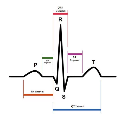 Surgical treatment of ciliary arrhythmia with the use of the cryo ablation technique