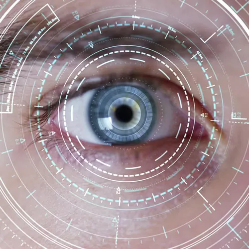 Laser eye microsurgery