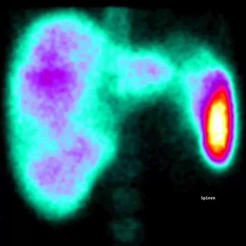 Liver and spleen examination