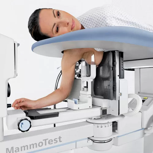 Mammography